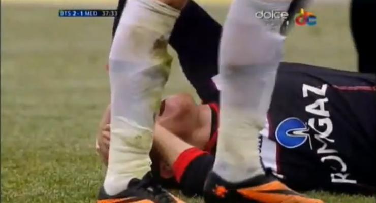 Страшное зрелище: Футболисту сломали ногу во время матча